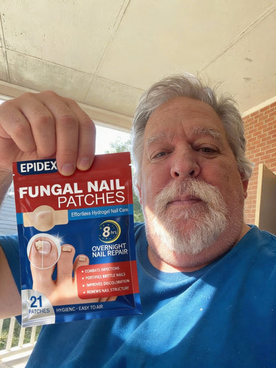 EPIDEX Fungal Nail Renewal Patches