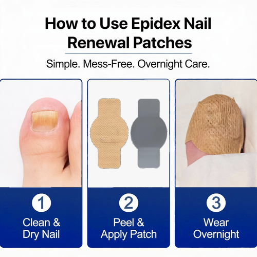 EPIDEX Fungal Nail Renewal Patches (3 Months)